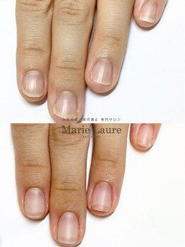 マリーロール 梅田店(Marie Laure)/自爪育成/深爪矯正/ネイルケア