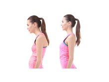 一善整骨院/猫背は背中のせいではないの？