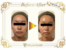 サン ボディバランス 亀戸/