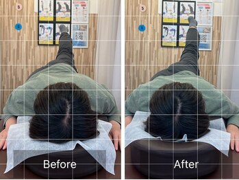 ナオル整体 札幌院(NAORU整体)/札幌円山/整体/姿勢矯正/猫背