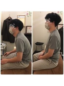 駒込整体院/猫背・姿勢改善