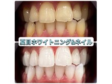 夏目ホワイトニングアンドネイル(夏目WHITENING＆NAIL)の雰囲気（簡単スピーディーなセルフホワイトニング）