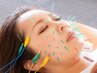 【小顔,たるみ改善特化！！】美容鍼＋通電 ¥4,500→¥3,980