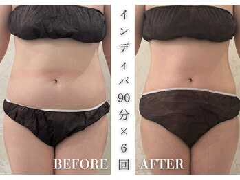 リアレント 高槻店(Lialent)/3ヶ月で無理なく-5kg達成♪