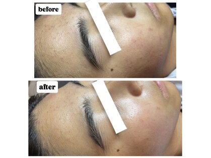 ミミ(mimi)の写真