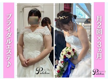 プルクレ 常磐町店(Pulchre)/ブライダルエステ