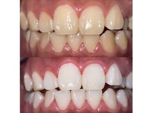 ホワイトニングビューティー 光の森店(WHITENING BEAUTY)