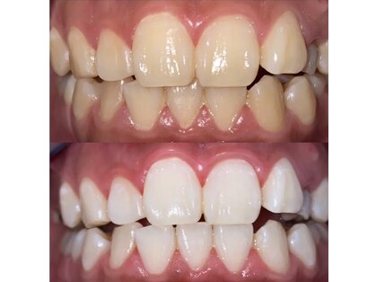 ホワイトニングビューティー 光の森店(WHITENING BEAUTY)の写真