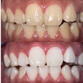 ホワイトニングビューティー 光の森店(WHITENING BEAUTY)