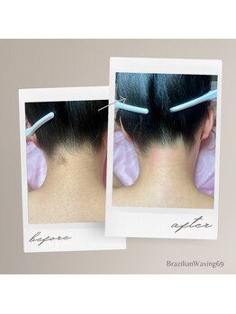 ブラジリアンワキシング シックスナイン(BrazilianWaxing69)/女性 / うなじ