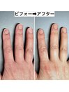 手の印象こんなに変わります2