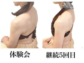 ユルポ(YuREPOS)の写真/【美背中/姿勢改善】年齢による変化やお悩み、産後の体ケアしたいけど自分ではできない方、プロにお任せ♪