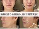 ブレア(Blair)の写真/サーマルRFでフェイスライン緩みをケア♪たるみエイジングケアで若々しい印象へ
