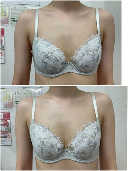 バーディー(BIRDIE)/施術１回/3０代