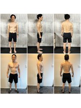 エボクシー(EVOXY)/Before＆after