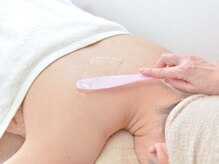 奏美の雰囲気(美肌脱毛:1部位から全身まで痛みを抑えた脱毛マシン)