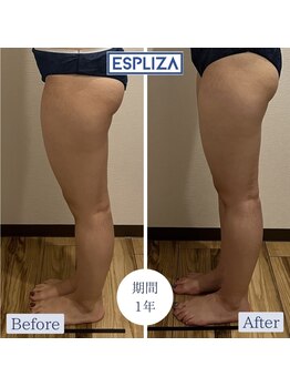 エスプライザ 鹿児島天文館店(ESPLIZA)/