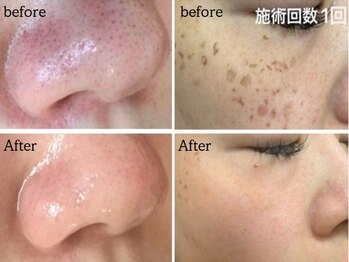 コウベ美容鍼灸治療院(KOBE美容鍼灸治療院)