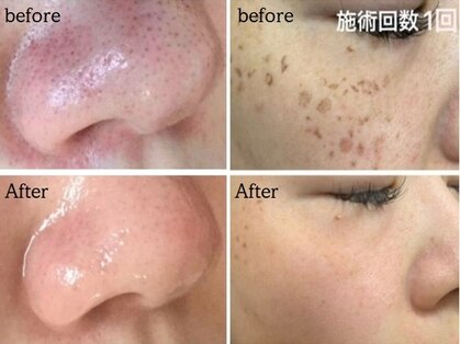 コウベ美容鍼灸治療院(KOBE美容鍼灸治療院)の写真