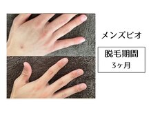 メンズビオ 神戸三宮店/