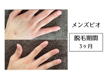 メンズビオ 神戸三宮店/