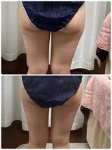 アスピリア(aspirer a')/痩せにくい下半身もスッキリ◎