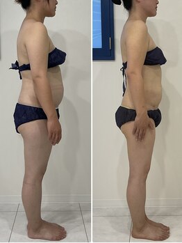 エゴ(EGO)/30代後半 152cm 5.4キロ減