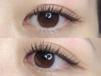 チャンプ 登美ケ丘店(Champ)/フラットラッシュ100本 ¥9570