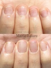 マリーロール 淀屋橋本店(Marie Laure)/自爪育成/深爪矯正/ネイルケア