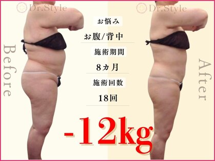 痩身エステ 美容整体 ドクタースタイル(Dr.Style)の写真