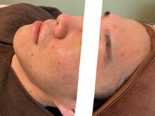 リセットプラス(Reset+)/