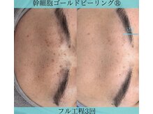 リメイククリニカルビューティー(Remake clinical beauty)/