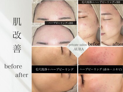 アウラ(AURA)の写真