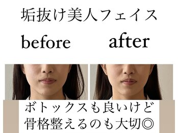 アールイー(Re:)