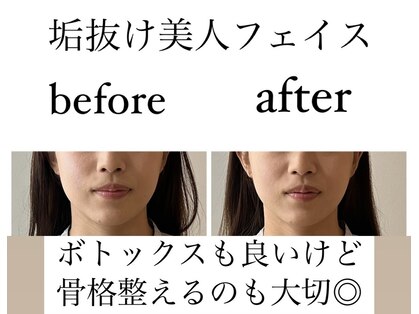 アールイー(Re:)の写真