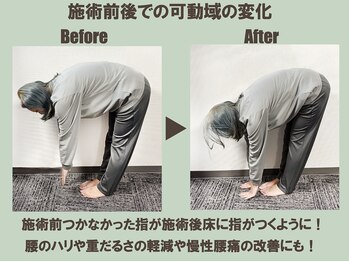 ストレッチリヴェラ(STRETCH LIVERA)/前屈の可動域の変化