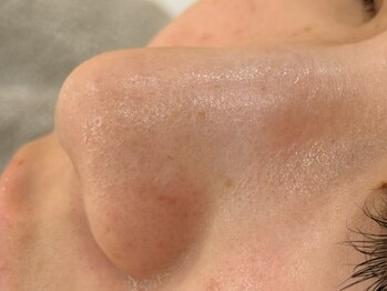 リライル(Lyraile)の写真/【天然素材のマツヤニwax使用＊】つるスベ素肌に導きます☆初めての方にもオススメ◎