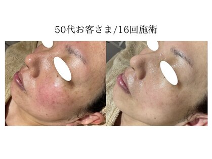 ラニエ(LANIE)の写真