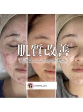 アンリミット 鹿児島天文館店(Une limit)/