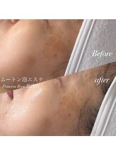 キレイシェア バイ プリンセスローズ静岡駅店(KIREI SHARE)/ムートン泡エステ