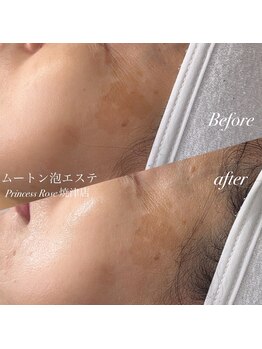 キレイシェア バイ プリンセスローズ静岡駅店(KIREI SHARE)/ムートン泡エステ