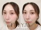 フレイヤ(FREYJA)の写真