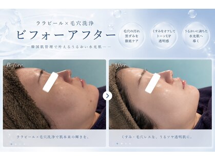 セローナ(Selona)の写真