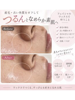 ホープリテーラー 日進店(HOPE Retailer)の写真/フェイシャルWaxで産毛をケアして、メイクノリが抜群に上がる素肌に！