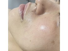 ナチュレ(Nature)/私史上最高のツヤ感！