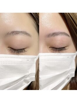 フー(fuu)/ハリウッドブロウリフト