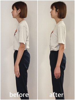 美容整体プラスキュー五反田/姿勢矯正・猫背改善