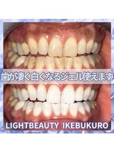 ライトビューティー 池袋店(LightBeauty)/症例写真