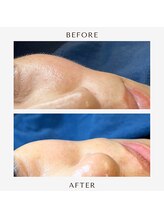 マーク(mark.)/化粧ノリ抜群！