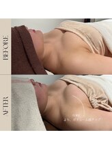 インフィニーズ(INFINEEZ)/カスタマイズ90分バストケア30代